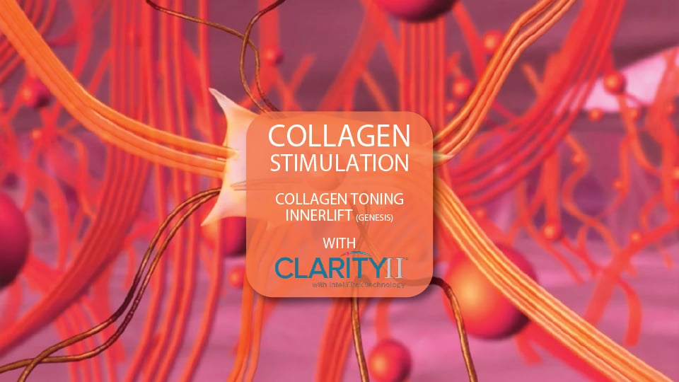 Clarity II™ Collagen Toning